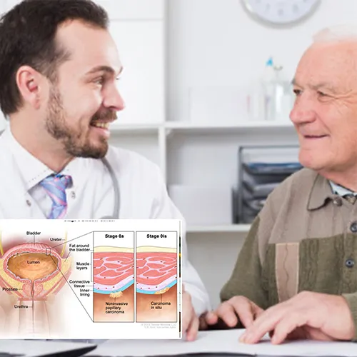 Understanding Your Options: Navigating the World of Penile Implants with   Florida Urology Partners 
