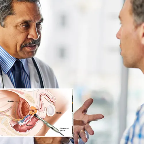 Welcome to   Florida Urology Partners 
: Understanding Your Options for Penile Implants